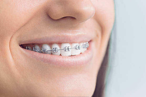 Why Choose Us for Your Dental Needs in Ossian, IN